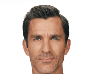 A model using our product Botox Cosmetic Treatment, Dermal Fillers, Double Chin Treatment, Skin Booster Treatment, Platelet-rich Plasma Injection, Thermage Treatment, Titan Skin Tightening Technology, Pearl Fractional Laser Treatment, Laser Genesis Treatment, Laser Toning Treatment, 3D Skin Rejuvenation Treatment, Intense Pulsed Light Therapy, Viora Radio Frequency Treatment, Blue Light Photodynamic Therapy, Laser Hair Removal, V-line Botox Treatment, Acne Scars Treatment, AviClear Laser Treatment, rosacea laser treatment, double chin removal, skin tightening treatment, Treatments for Uneven Skin Tone, Pigmentation Treatment, pore treatment, sweating botox treatment, Hair Loss Treatments, Non-Contact Fat Reduction, CoolSculpting, Redefining Muscle Sculpting, Ideal Protein Weight Loss Program, Microneedling Therapy, Microdermabrasion Therapy, and Chemical Peel by Trinity Medispa a Medical Cosmetic Clinic in Toronto located at 3434 Yonge St., Toronto, ON M4N 2M9.