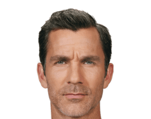 A model using our product Botox Cosmetic Treatment, Dermal Fillers, Double Chin Treatment, Skin Booster Treatment, Platelet-rich Plasma Injection, Thermage Treatment, Titan Skin Tightening Technology, Pearl Fractional Laser Treatment, Laser Genesis Treatment, Laser Toning Treatment, 3D Skin Rejuvenation Treatment, Intense Pulsed Light Therapy, Viora Radio Frequency Treatment, Blue Light Photodynamic Therapy, Laser Hair Removal, V-line Botox Treatment, Acne Scars Treatment, AviClear Laser Treatment, rosacea laser treatment, double chin removal, skin tightening treatment, Treatments for Uneven Skin Tone, Pigmentation Treatment, pore treatment, sweating botox treatment, Hair Loss Treatments, Non-Contact Fat Reduction, CoolSculpting, Redefining Muscle Sculpting, Ideal Protein Weight Loss Program, Microneedling Therapy, Microdermabrasion Therapy, and Chemical Peel by Trinity Medispa a Medical Cosmetic Clinic in Toronto located at 3434 Yonge St., Toronto, ON M4N 2M9.