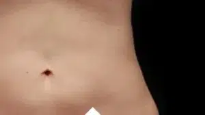 A model using our product Botox Cosmetic Treatment, Dermal Fillers, Double Chin Treatment, Skin Booster Treatment, Platelet-rich Plasma Injection, Thermage Treatment, Titan Skin Tightening Technology, Pearl Fractional Laser Treatment, Laser Genesis Treatment, Laser Toning Treatment, 3D Skin Rejuvenation Treatment, Intense Pulsed Light Therapy, Viora Radio Frequency Treatment, Blue Light Photodynamic Therapy, Laser Hair Removal, V-line Botox Treatment, Acne Scars Treatment, AviClear Laser Treatment, rosacea laser treatment, double chin removal, skin tightening treatment, Treatments for Uneven Skin Tone, Pigmentation Treatment, pore treatment, sweating botox treatment, Hair Loss Treatments, Non-Contact Fat Reduction, CoolSculpting, Redefining Muscle Sculpting, Ideal Protein Weight Loss Program, Microneedling Therapy, Microdermabrasion Therapy, and Chemical Peel by Trinity Medispa a Medical Cosmetic Clinic in Toronto located at 3434 Yonge St., Toronto, ON M4N 2M9.