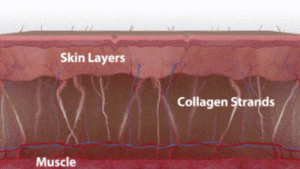 A model using our product Botox Cosmetic Treatment, Dermal Fillers, Double Chin Treatment, Skin Booster Treatment, Platelet-rich Plasma Injection, Thermage Treatment, Titan Skin Tightening Technology, Pearl Fractional Laser Treatment, Laser Genesis Treatment, Laser Toning Treatment, 3D Skin Rejuvenation Treatment, Intense Pulsed Light Therapy, Viora Radio Frequency Treatment, Blue Light Photodynamic Therapy, Laser Hair Removal, V-line Botox Treatment, Acne Scars Treatment, AviClear Laser Treatment, rosacea laser treatment, double chin removal, skin tightening treatment, Treatments for Uneven Skin Tone, Pigmentation Treatment, pore treatment, sweating botox treatment, Hair Loss Treatments, Non-Contact Fat Reduction, CoolSculpting, Redefining Muscle Sculpting, Ideal Protein Weight Loss Program, Microneedling Therapy, Microdermabrasion Therapy, and Chemical Peel by Trinity Medispa a Medical Cosmetic Clinic in Toronto located at 3434 Yonge St., Toronto, ON M4N 2M9.
